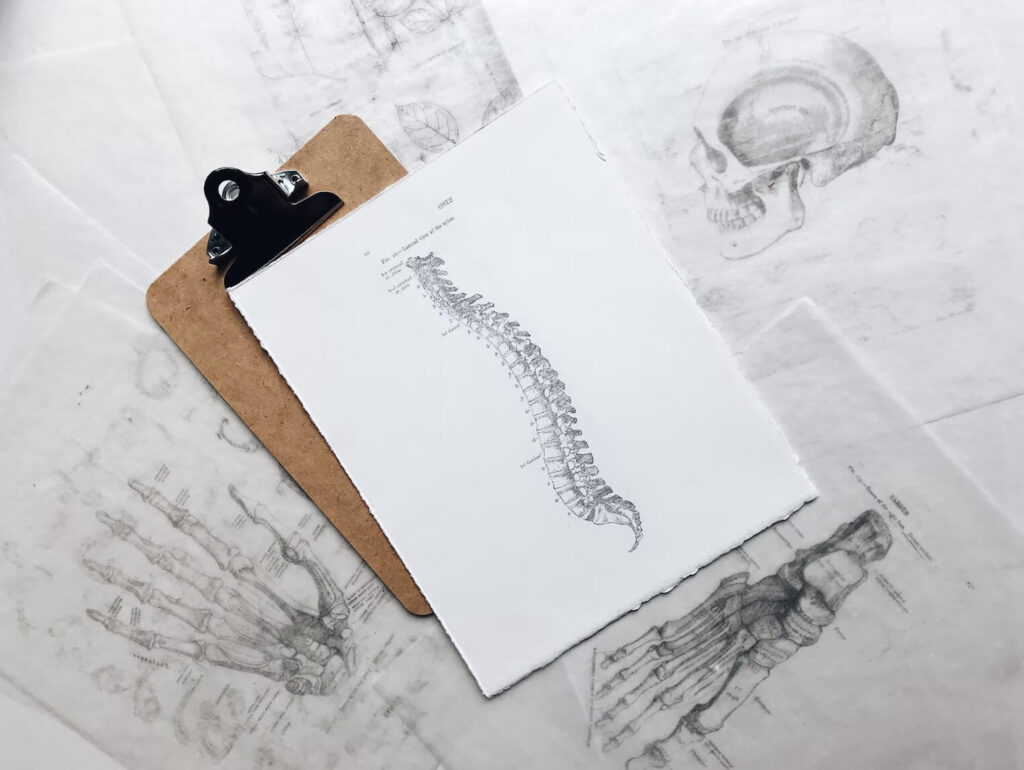 Clip board with drawings of bones and spine, cared for at Real Life Chiropractic in Springville UT.